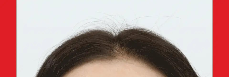 [대용량 샴푸 기획] 닥터포헤어 폴리젠 바이오-3 샴푸 750ml+ 200ml 탈모증상완화 샴푸 상세페이지 17
